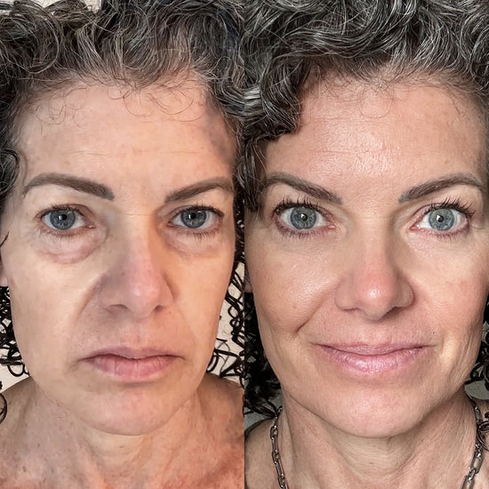 Doza RevitalEyes